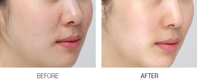 MEDI-PEEL Vitamin Bomb_kimmi.jpg